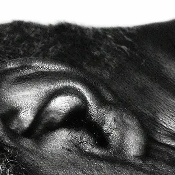 Might SSRIs for depression, anxiety make tinnitus worse?