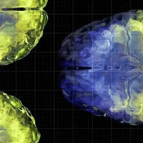 Aging brain health: Vitamin C levels linked to gray matter volume