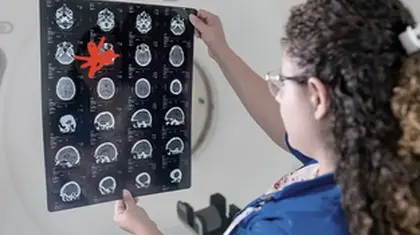 Alzheimer's: Ultrasound gets aducanumab straight to the brain