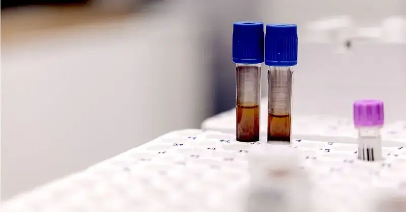 Anemia may increase the risk of dementia by as much as 66%